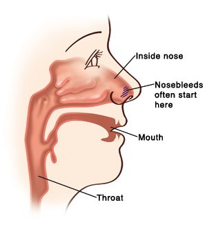 Nosebleed Diagram