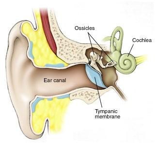 Vertigo Diagram